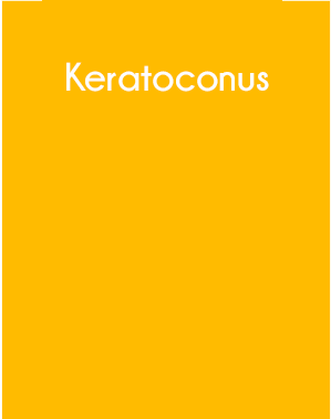 Keratoconus Modulo4